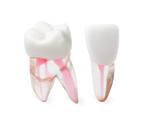 Acadental # RT_AE401_08