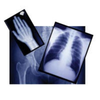 Agfa Corporation # 3XA2A