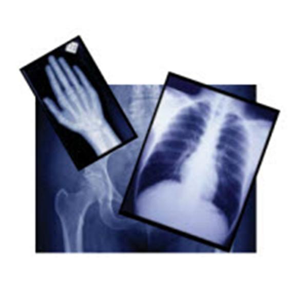 Agfa Corporation # 3XA5G