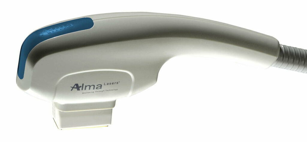 Alma Lasers # AAHP02110614