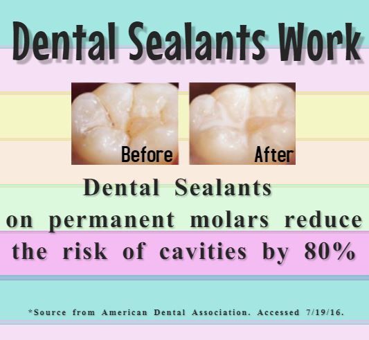 American Dental Assoc # W223
