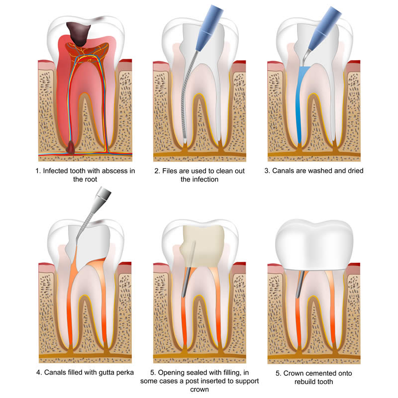 American Dental Assoc # W244
