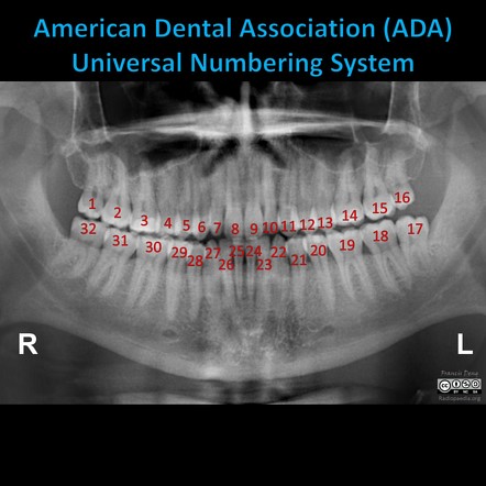American Dental Assoc # W566