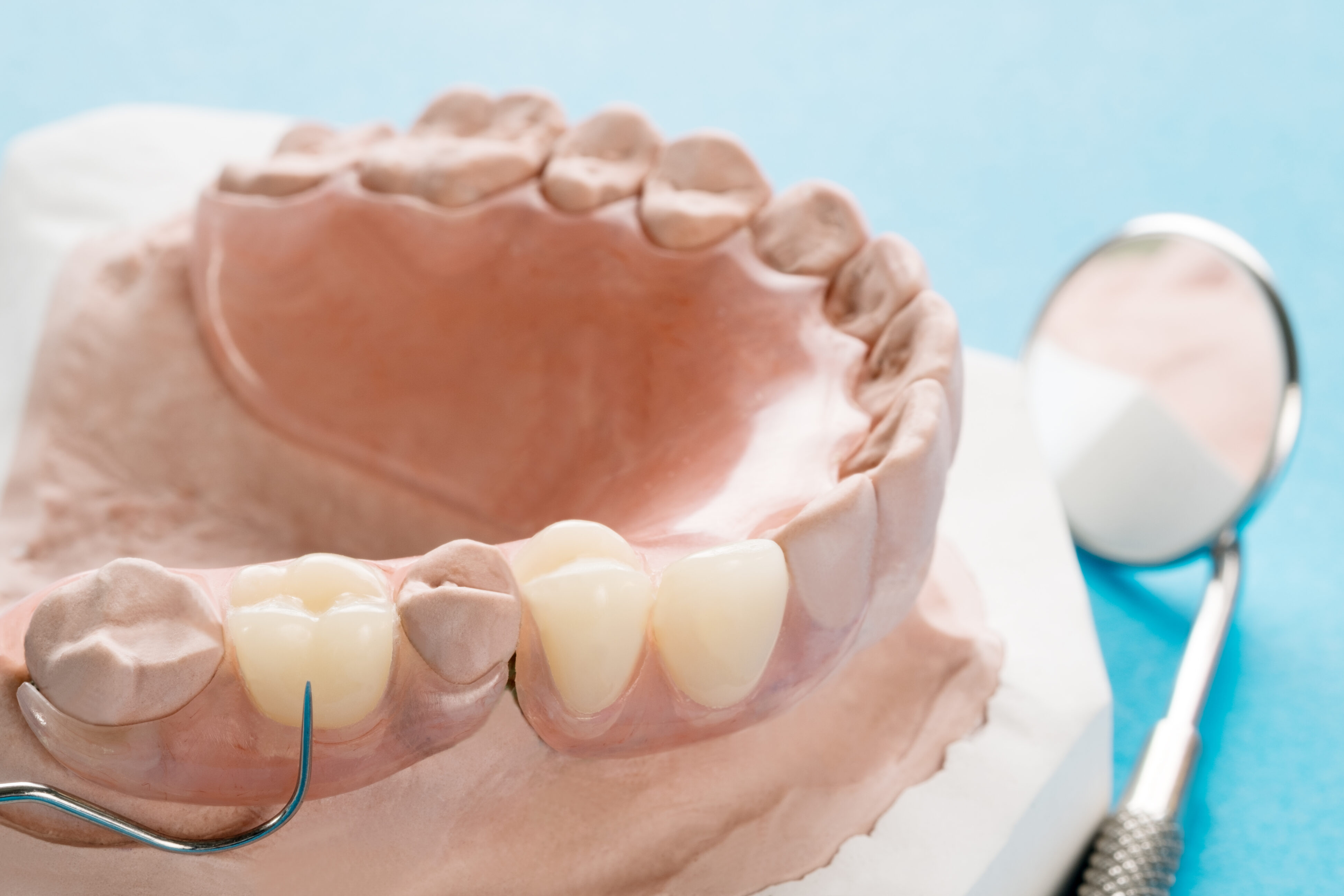 American Tooth Ind # 04-0017