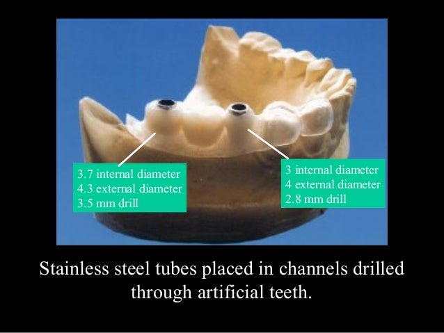 American Tooth Ind # 4-212-4040