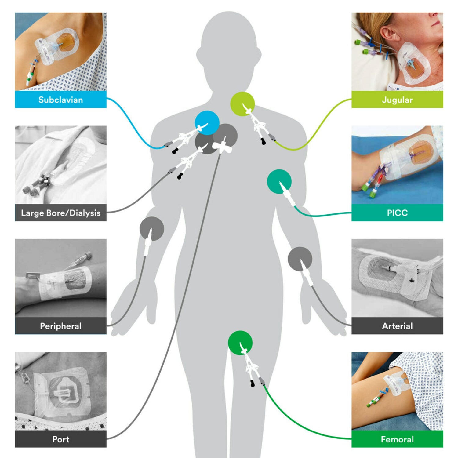 Bard Medical # PICK0116