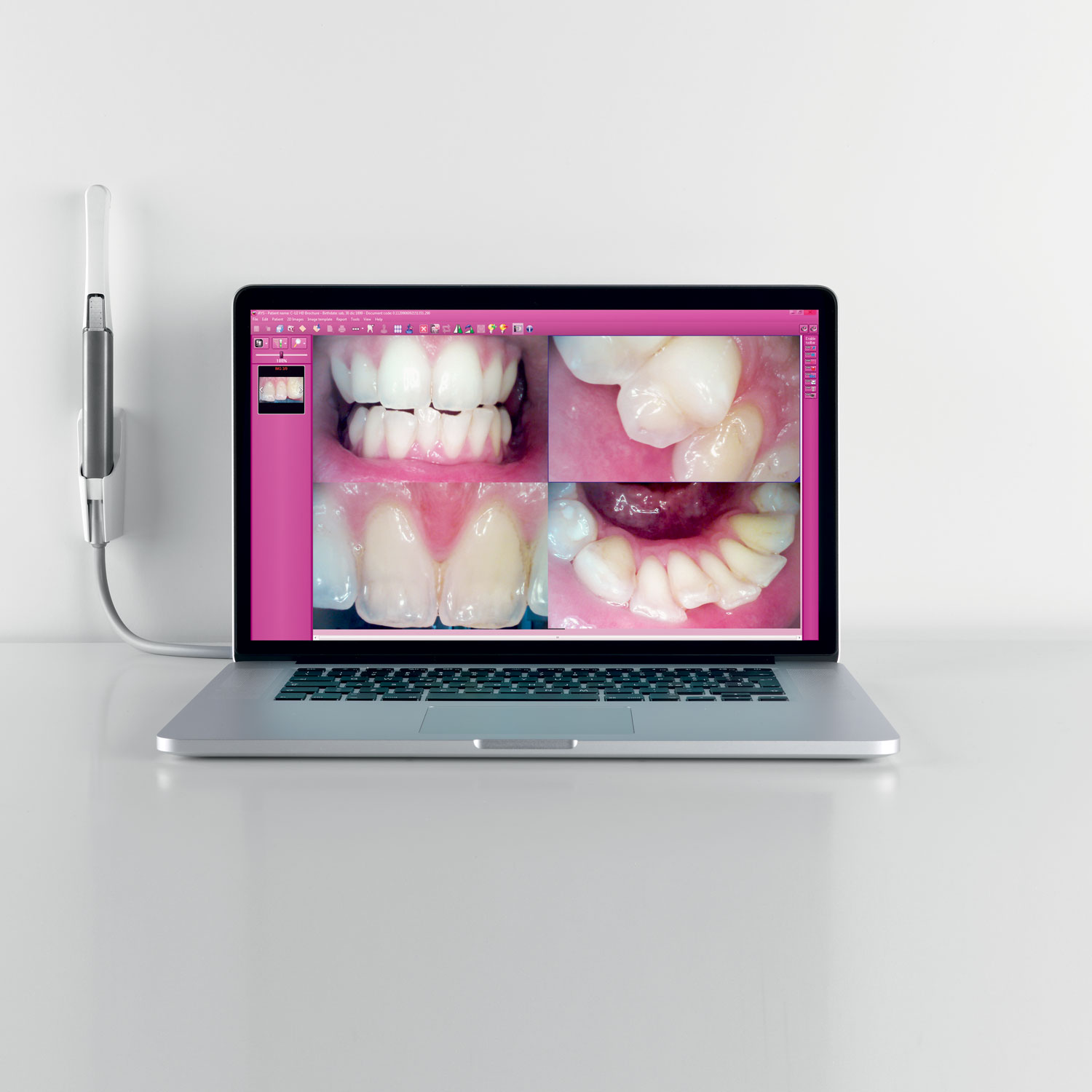 Cefla Dental Group # 70200100