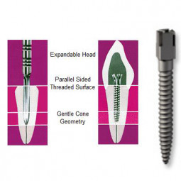 Dentatus USA # SST-EL6