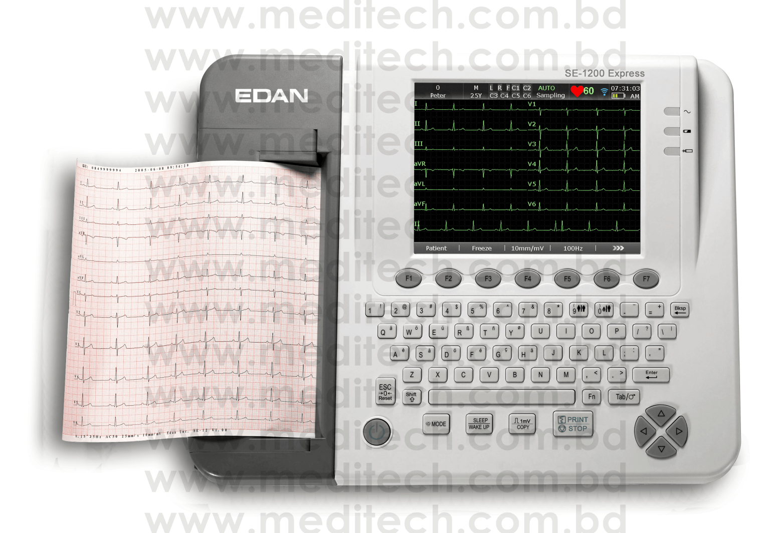 Edan Diagnostics # 12ECG_Plate