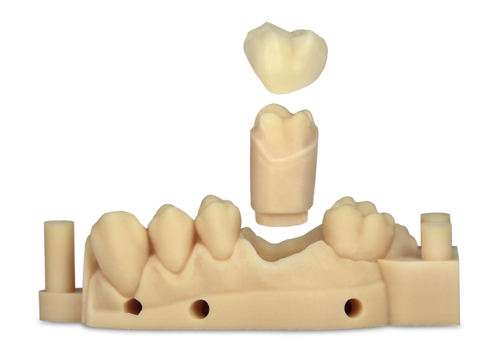 Envisiontec # KG-E-DENT A1