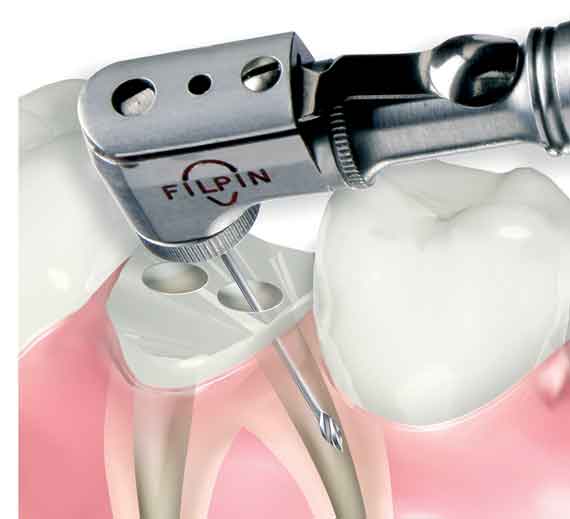 Filhol Dental # CPL401