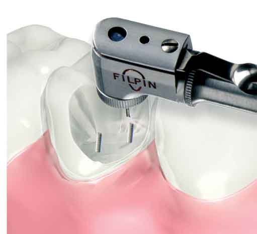 Filhol Dental # PIN114