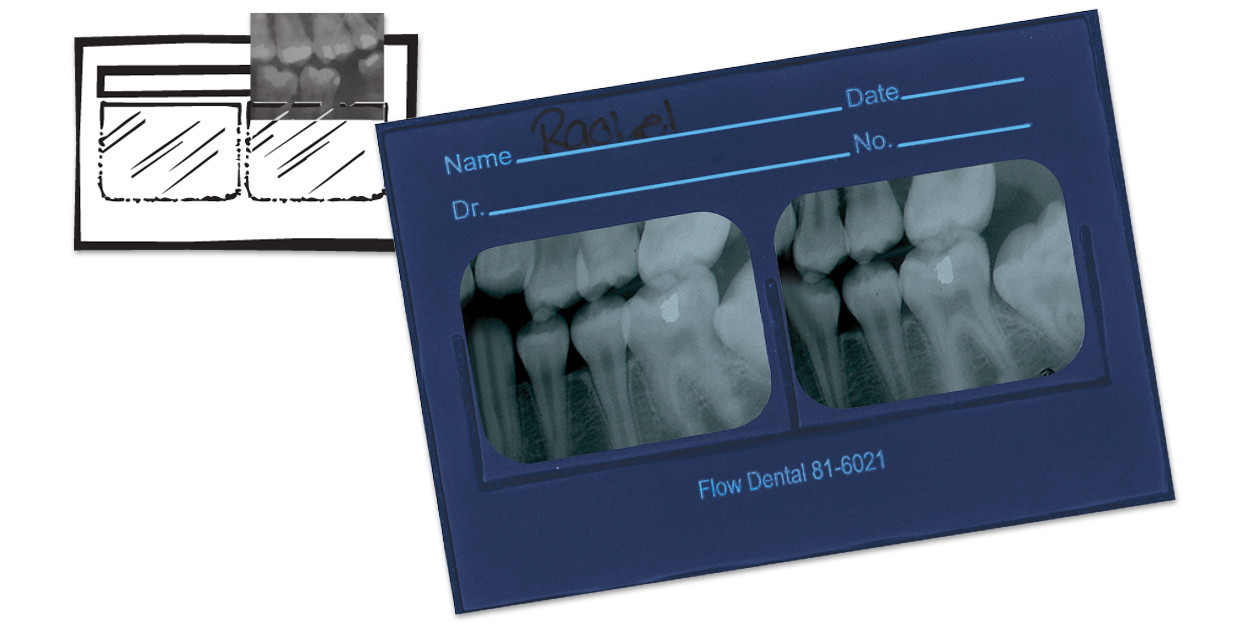 Flow X-Ray # 81-6021