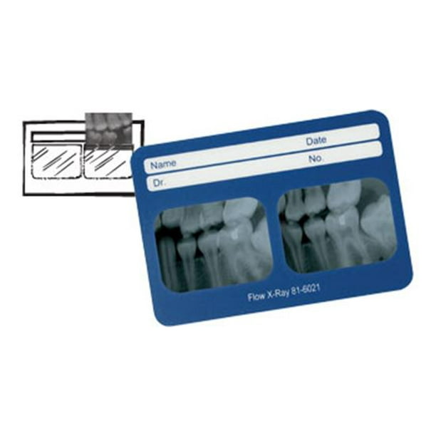 Flow X-Ray # 81-6180