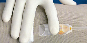 Fresenius Kabi # 820-6013-33