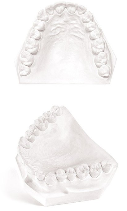 Garreco # 1106450