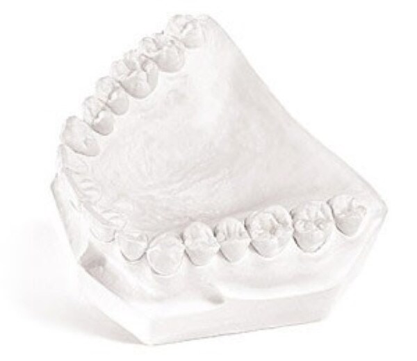 Garreco # 1560025