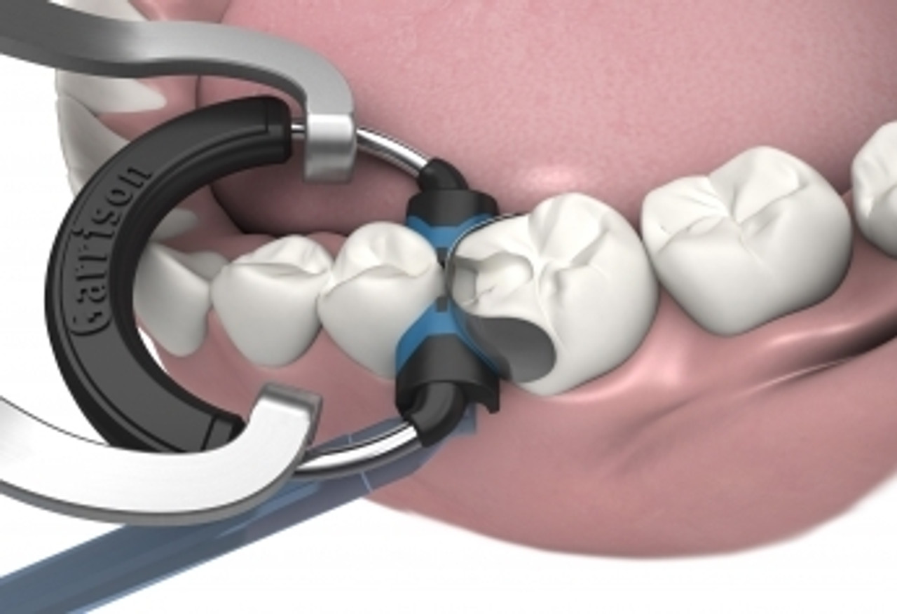 Garrison Dental Solutions # 3D-KSW-10