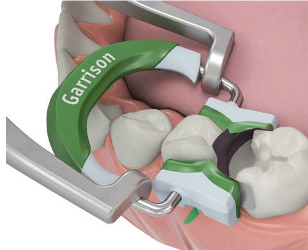 Garrison Dental Solutions # AU100