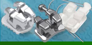 Great Lakes Orthodontics # GL1712