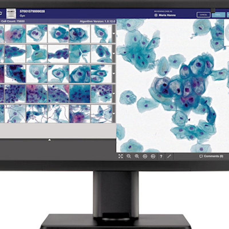 Hologic # IRIS-ENT