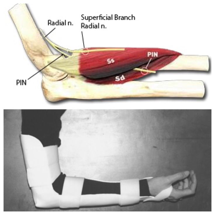 Hygenic/Theraband # 81428275
