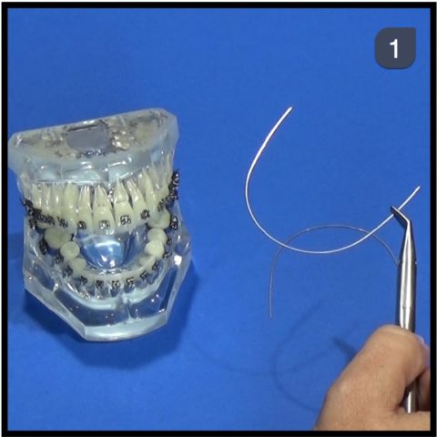 Lancer Orthodontic # 537-216
