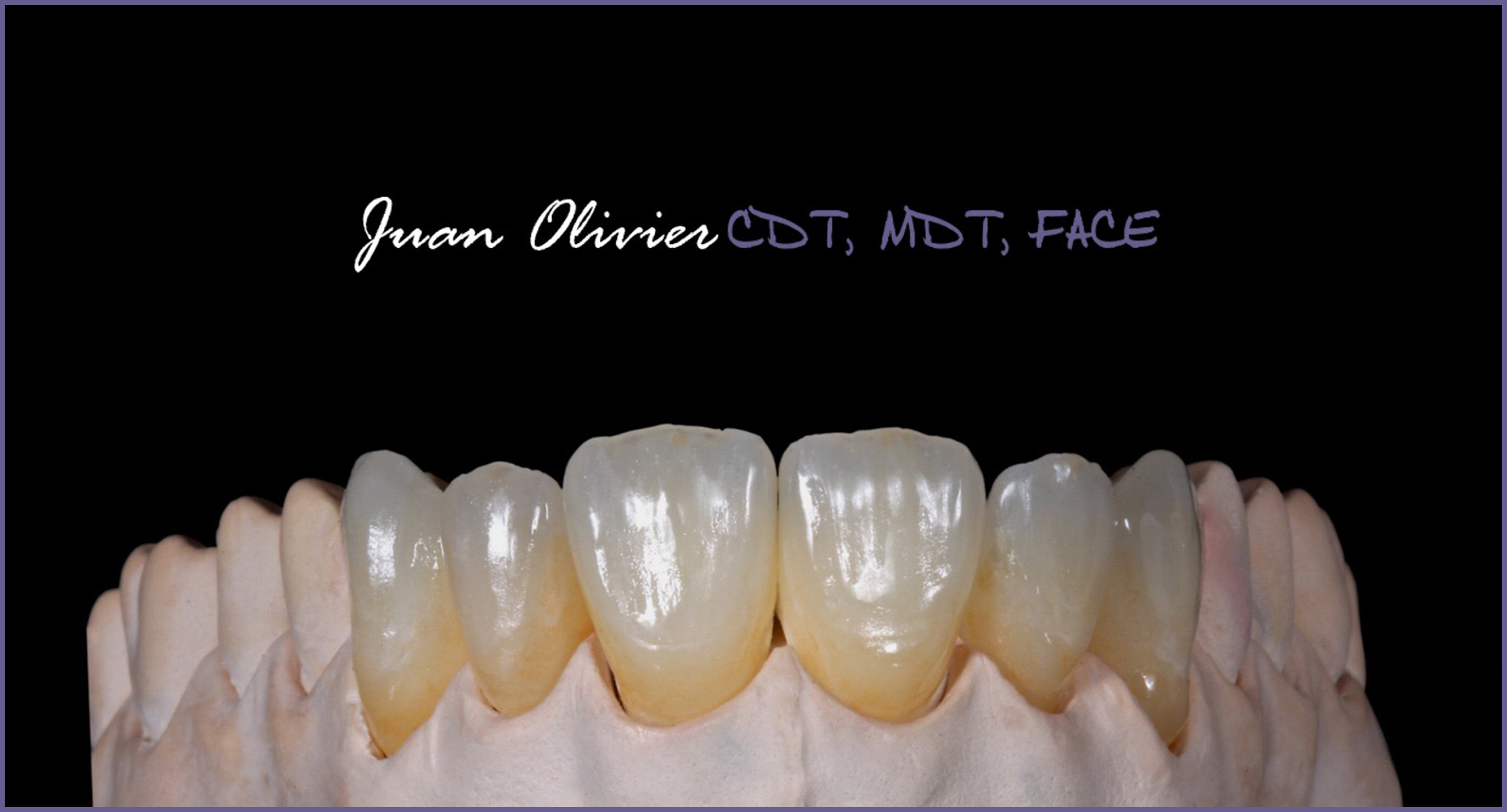 Master Ceramist # 424-DLC-BI