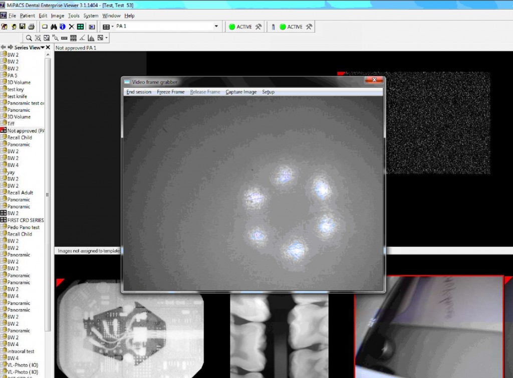 Medicor Imaging # MP-HS-REMOTE