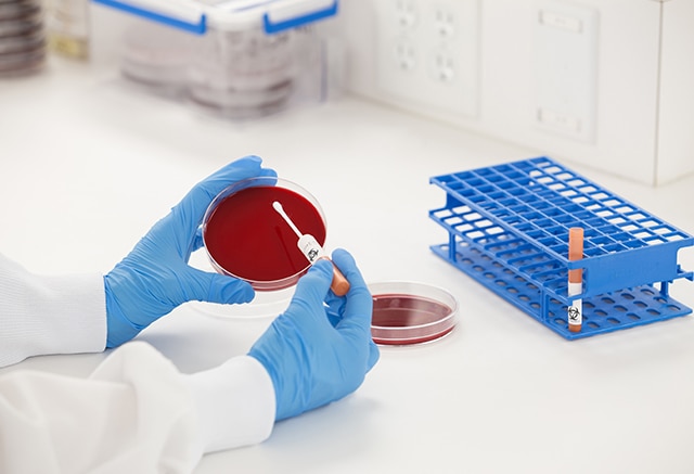 Microbiologics # 0481K