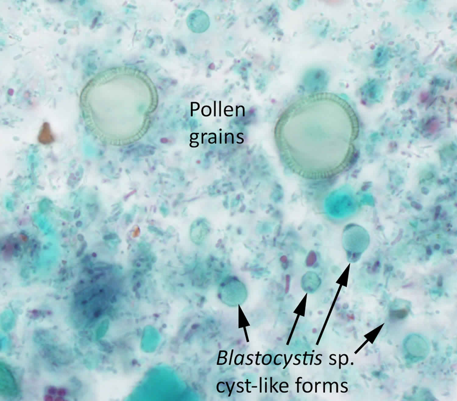 Microbiologics # FP07