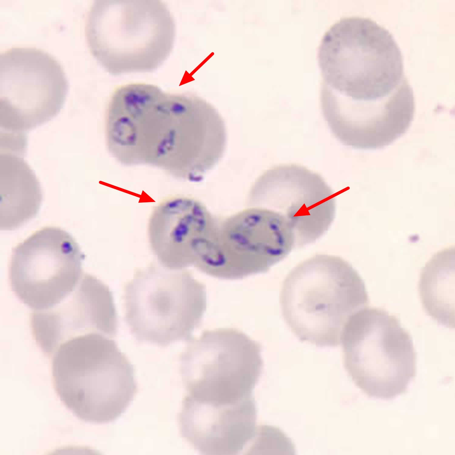 Microbiologics # SL9010
