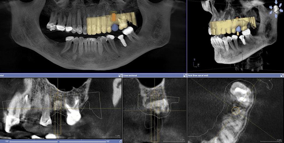 Min X-Ray # 11240