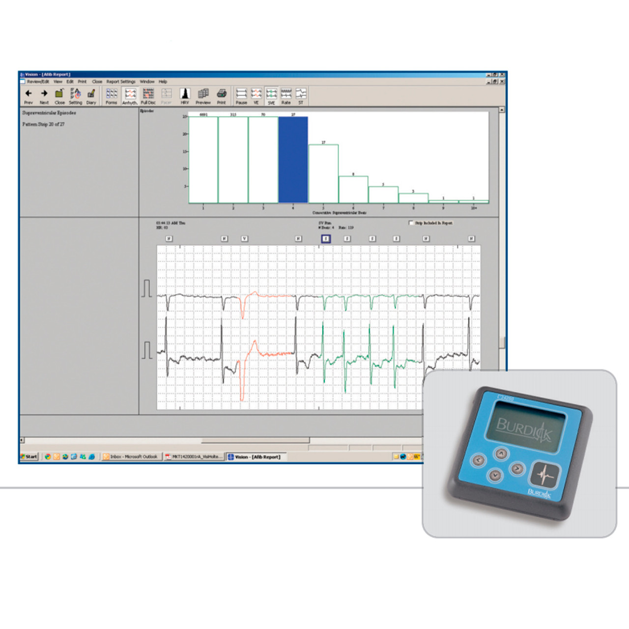 Mortara Instrument # BURV53H-0