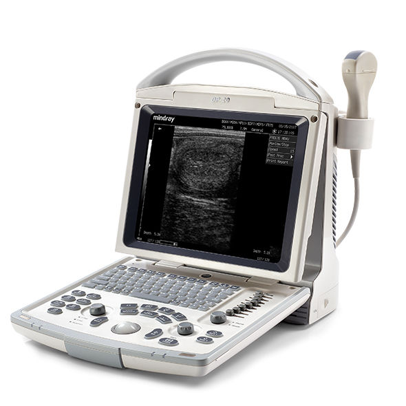 National Ultrasound # QUOTE 3260