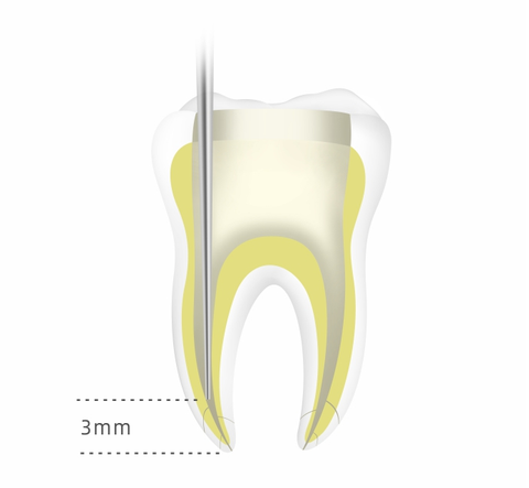 Neo Dental # NF