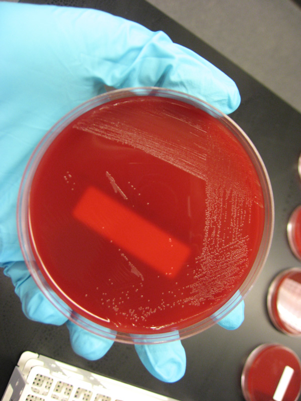 PML Microbiologicals # 121469