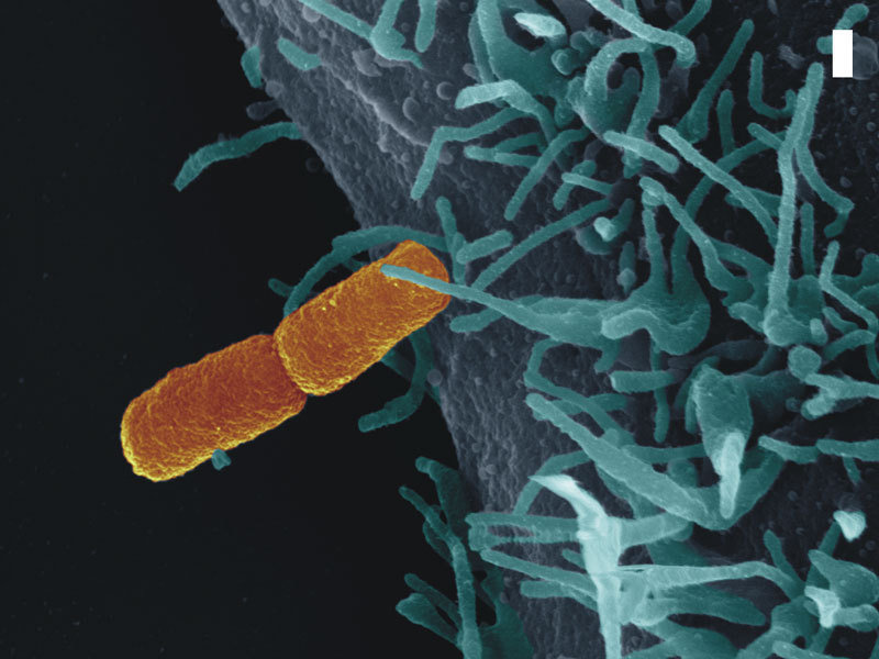 PML Microbiologicals # 121660