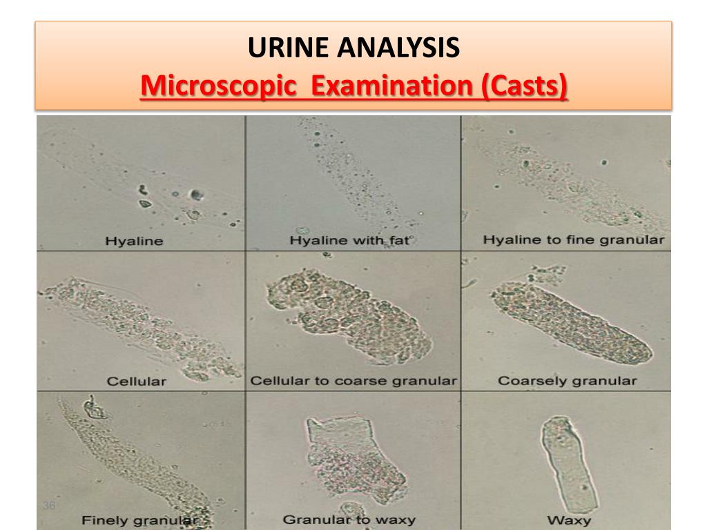 PML Microbiologicals # C1600