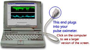 ProFox # 12525