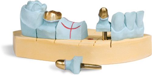 PTC Dental # 500-100