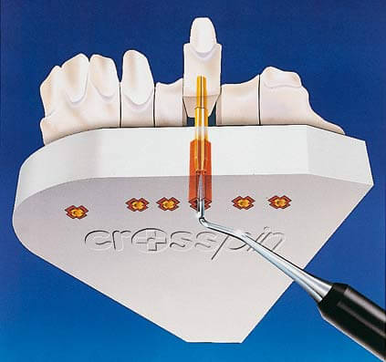PTC Dental # 500-101