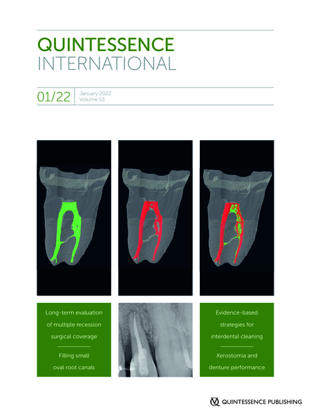 Quintessence Publishing # J1100