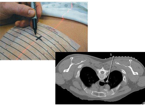 SourceOne Healthcare # 419552