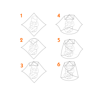 Specialty Medical Products # ND-FS