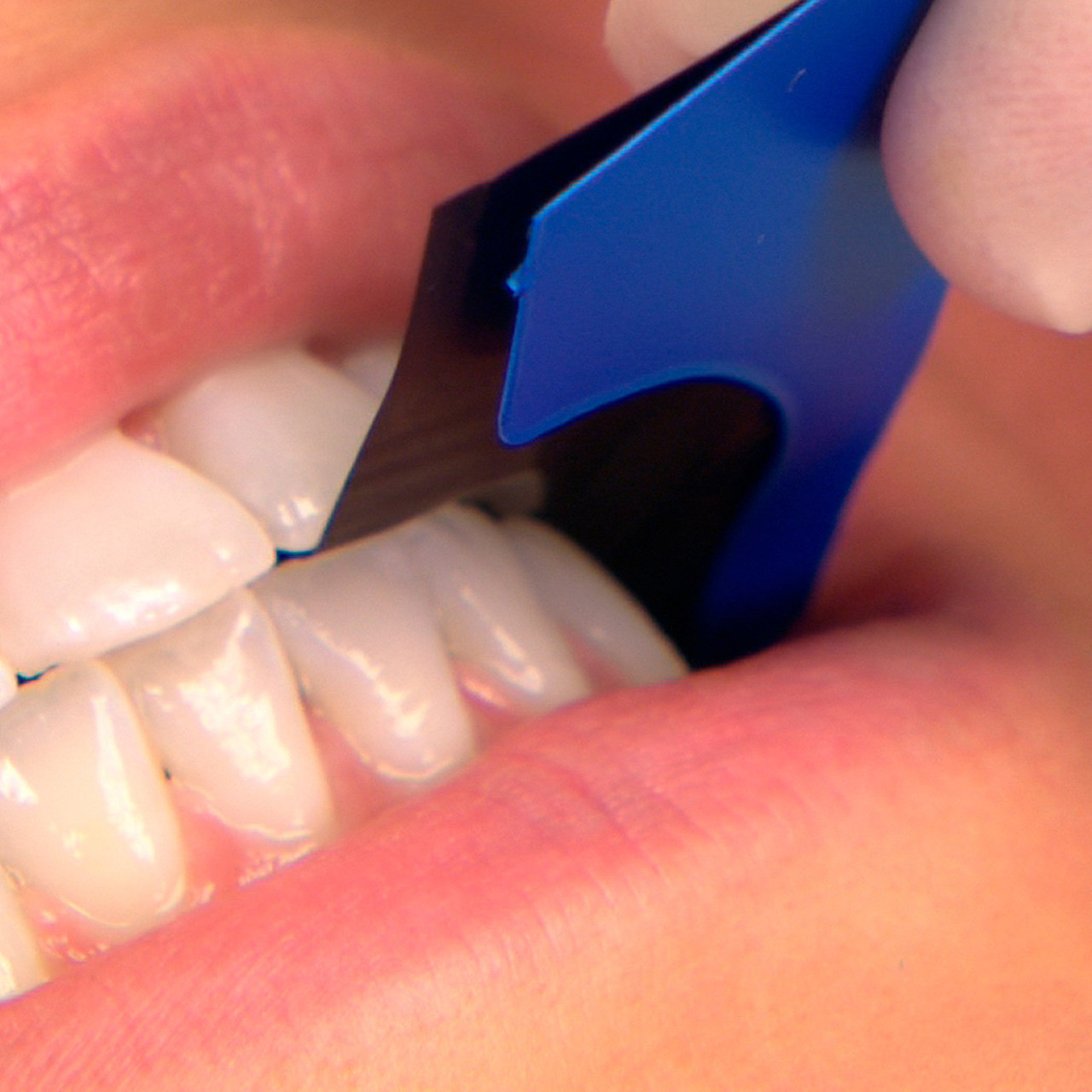 TrollDental # 12000700