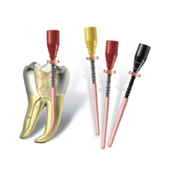 US Endodontics # US0203006OBT